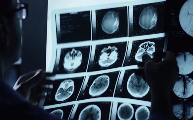 ibm research medical imaging